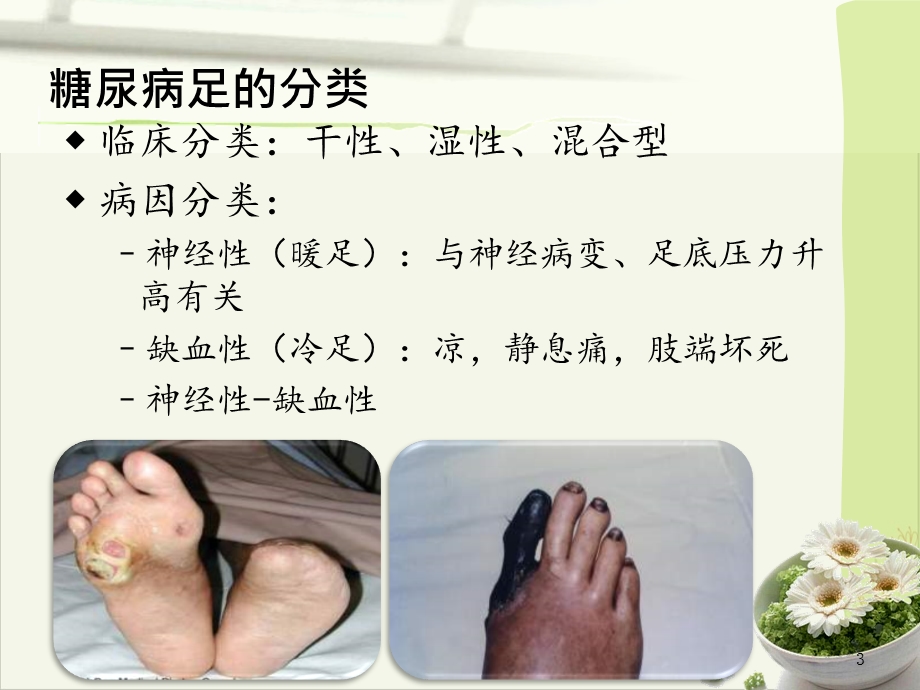 糖尿病足的预防与治疗实用课件.pptx_第3页