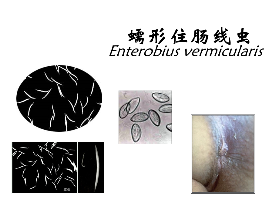 线虫、昆虫 课件.ppt_第2页