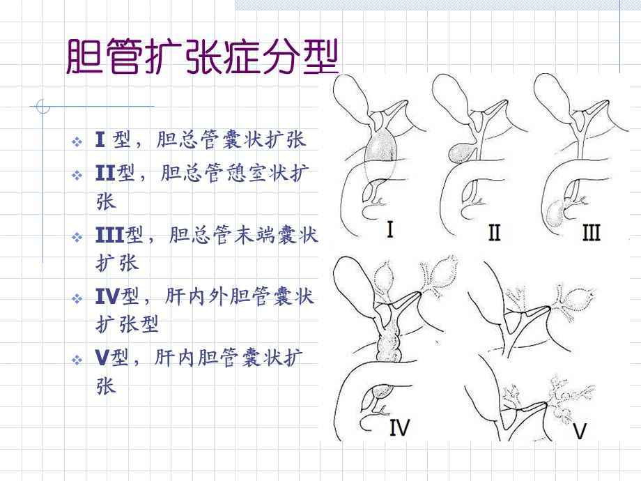 胆总管囊肿诊疗常规培训ppt课件.ppt_第3页