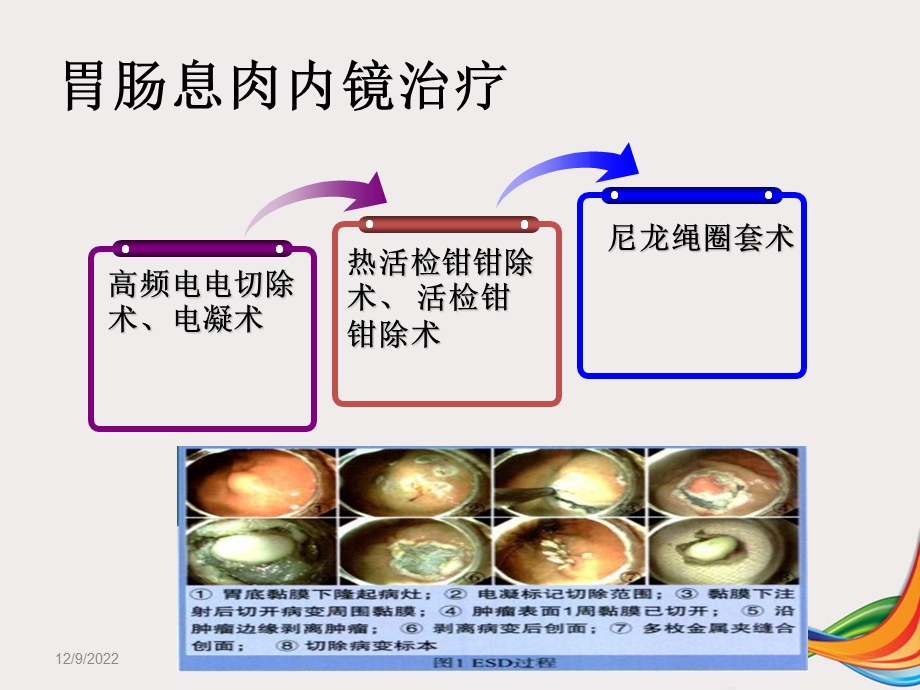 胃肠息肉摘除术课件.ppt_第3页