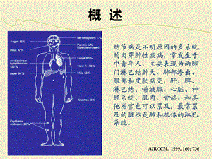 结节病发病机制及诊治进展课件.ppt