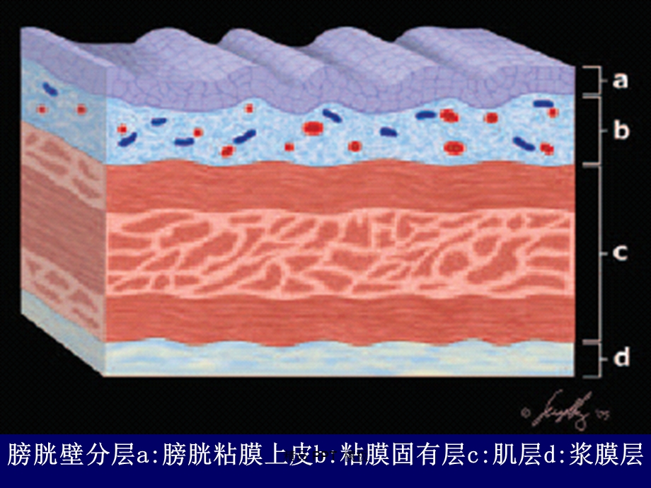 膀胱肿瘤影像诊断(ppt课件).ppt_第3页