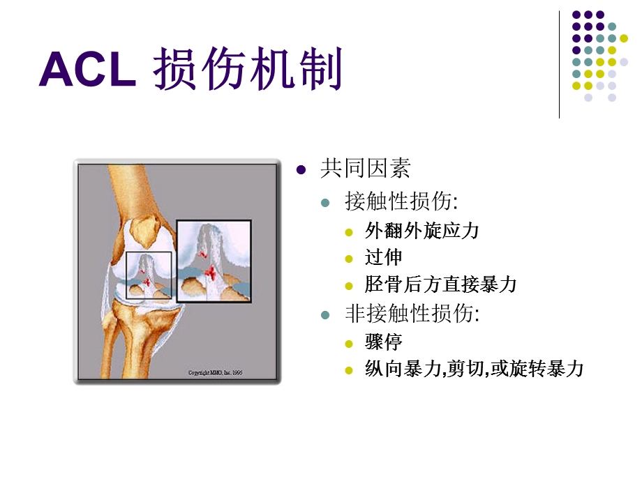 膝关节前交叉韧带损伤诊断与治疗课件.ppt_第2页