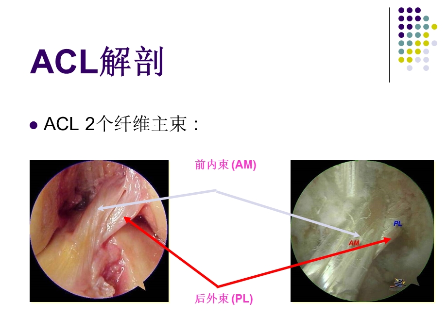 膝关节前交叉韧带损伤诊断与治疗课件.ppt_第3页