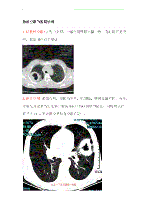 肺部空洞的鉴别诊断.doc