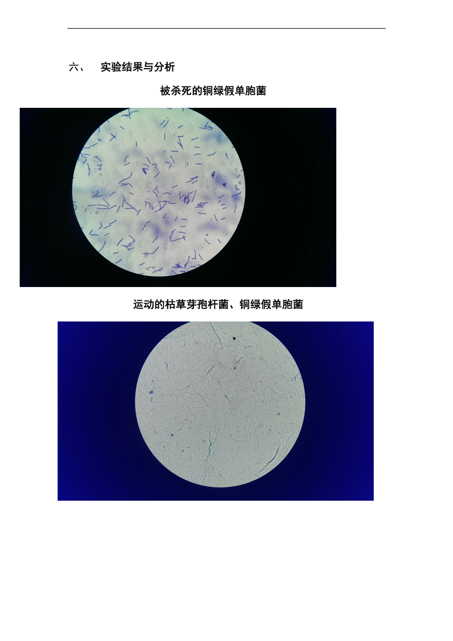 实验四观察鞭毛菌地运动细菌鞭毛染色.doc_第3页