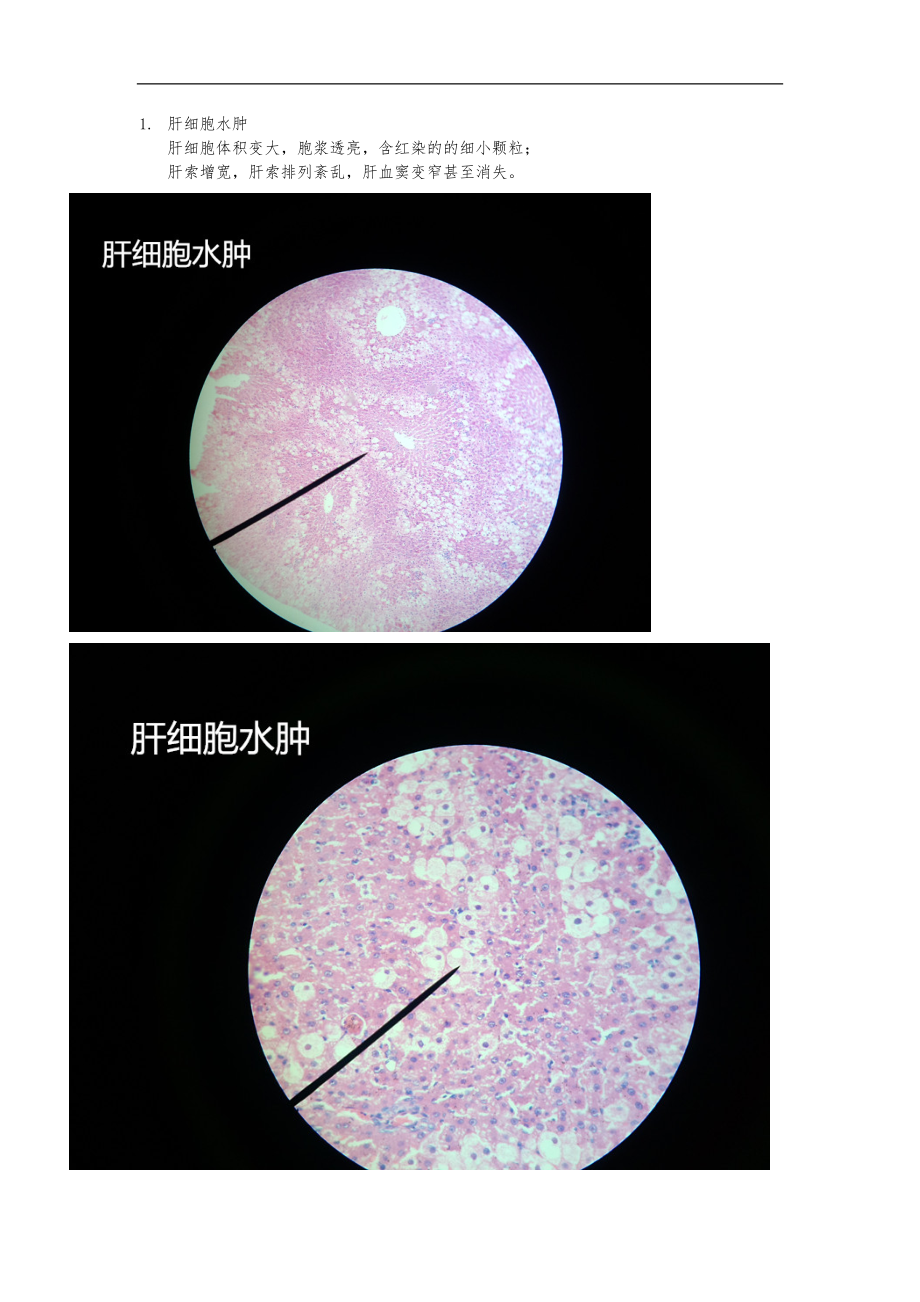 病理学-镜下切片.doc_第1页