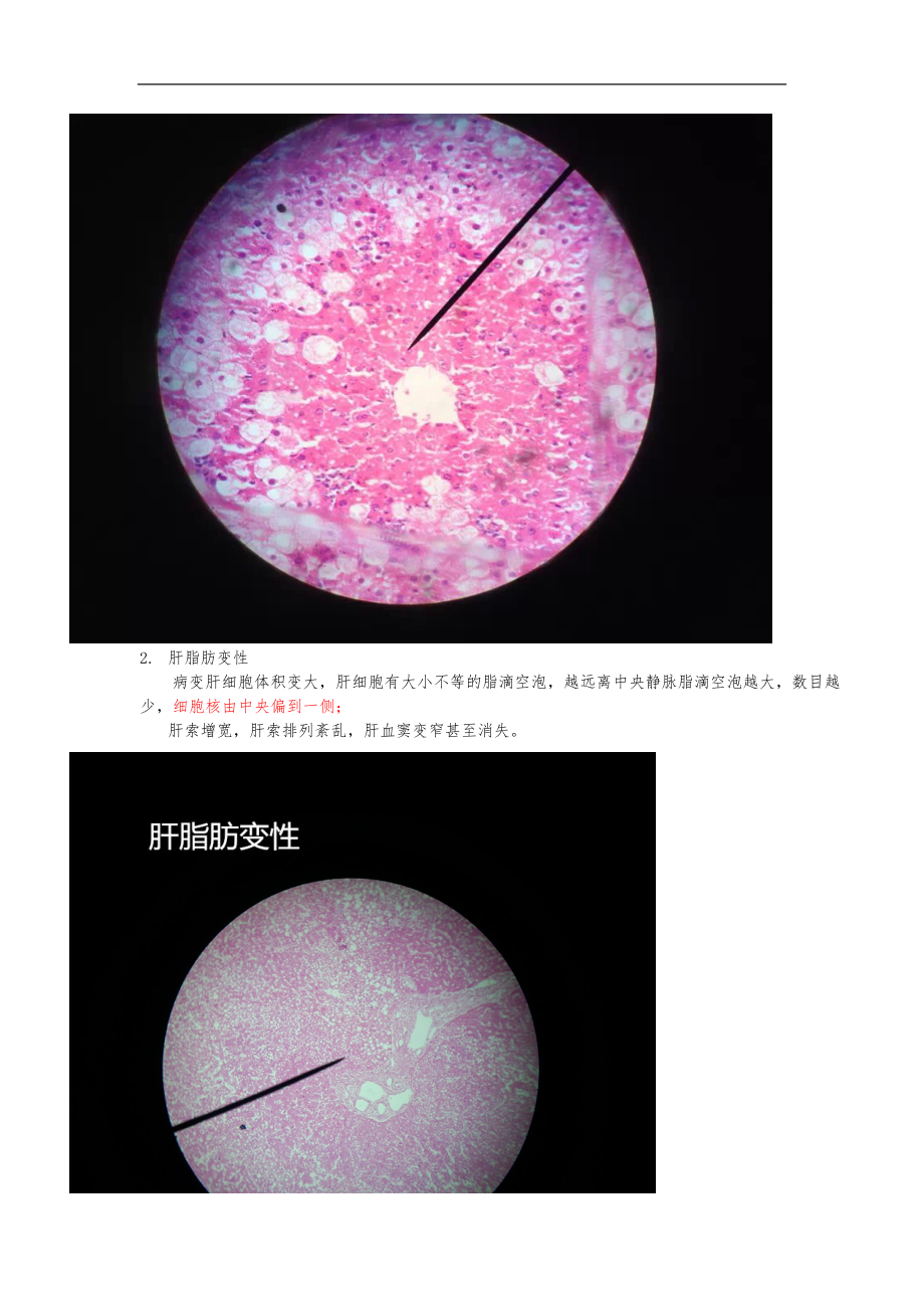 病理学-镜下切片.doc_第2页