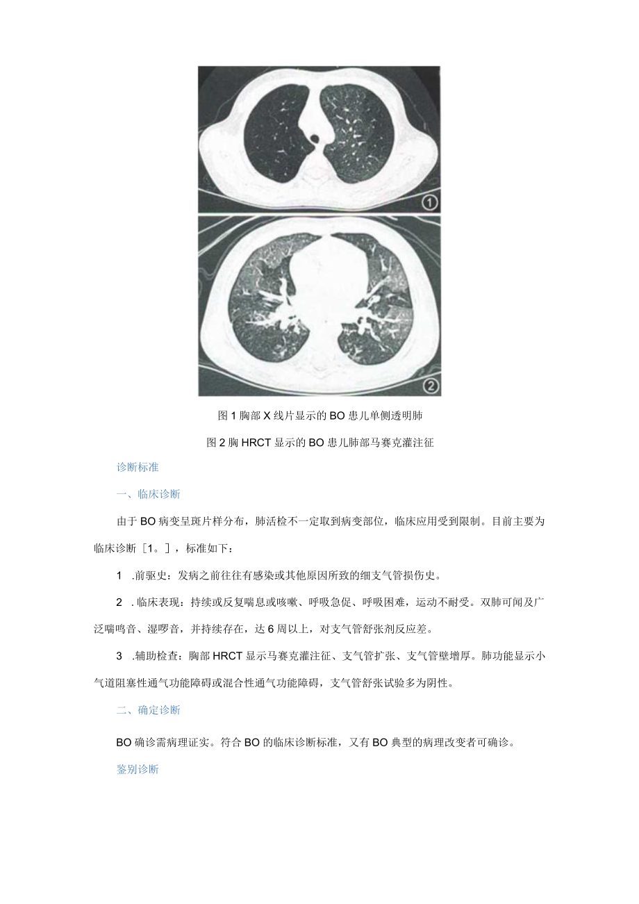 儿童闭塞性细支气管炎的诊断与治疗建议.docx_第3页