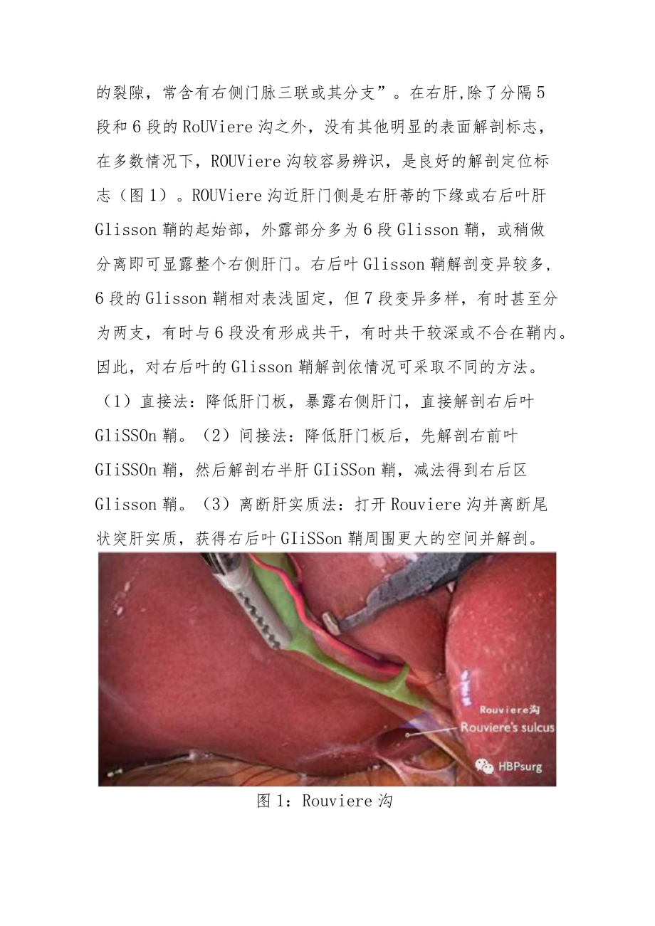 腹腔镜肝切除的解剖入路(1).docx_第3页