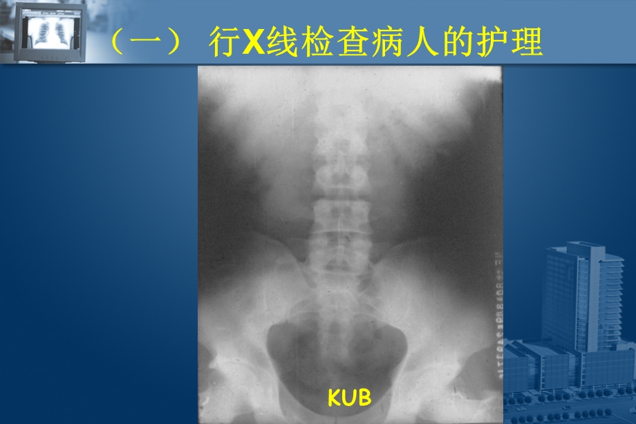 第十九章泌尿系统泌尿系常用的诊疗操作.ppt_第3页