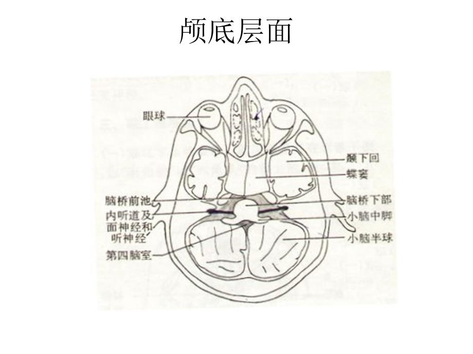 脑头颅CT示意图.ppt_第2页