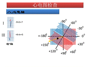 心电图检查.ppt