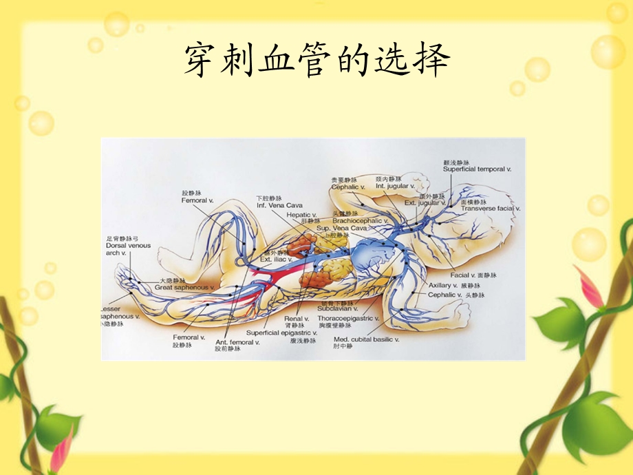 极低出生体重儿PICC临床应用.ppt_第3页