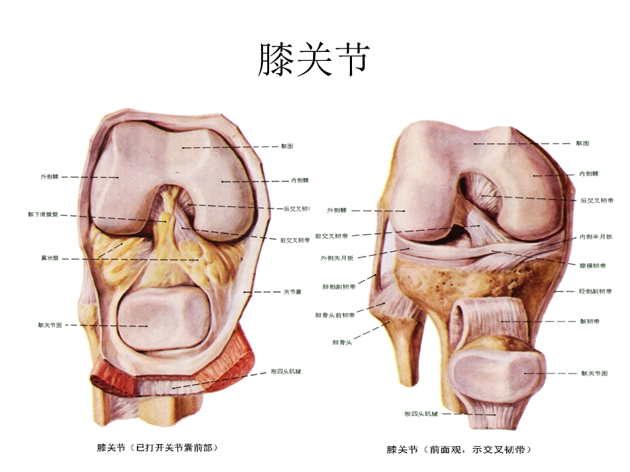 膝关节置换术.ppt_第3页