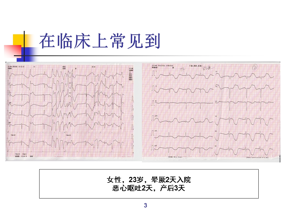 心律失常紧急处理.ppt_第3页