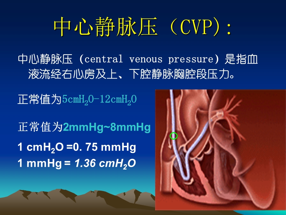 中心静脉压(CVP)监测及波形分析..ppt_第3页