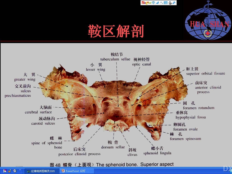 鞍区病变影像诊断(上).ppt_第2页