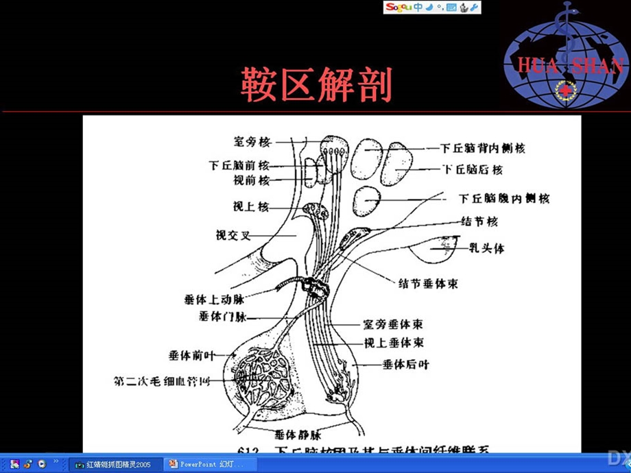 鞍区病变影像诊断(上).ppt_第3页