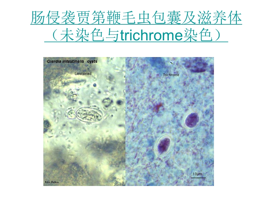 寄生虫切片.ppt_第2页