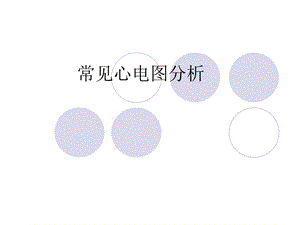 常见心电图分析.ppt