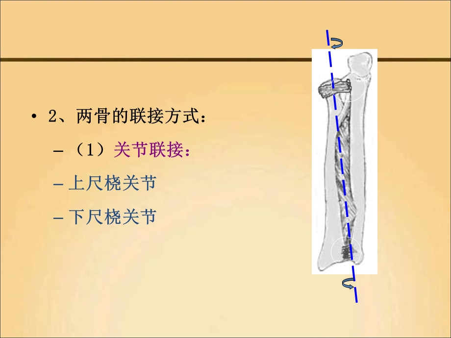 尺桡骨骨折护理.ppt_第3页