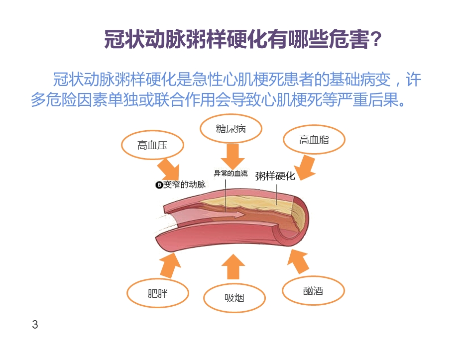 冠心病患者如何改善生活方式.ppt_第3页