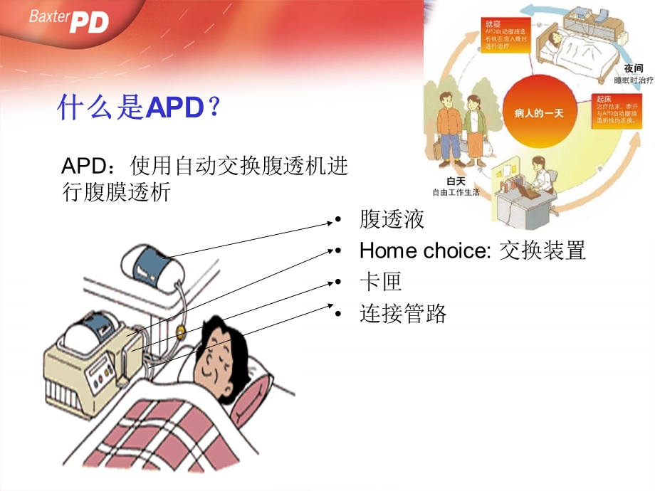 APD(自动化腹膜透析)的优势.ppt_第3页