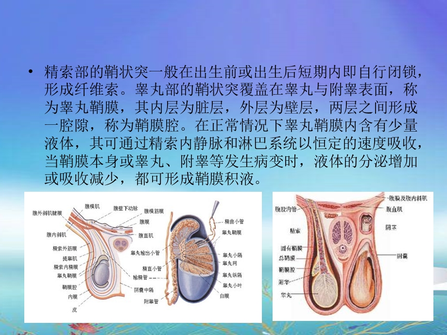 鞘膜积液业务学习学习总结总结汇报实用文档.ppt_第3页