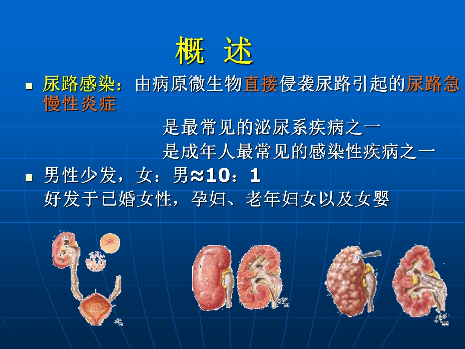 尿路感染病人的护理.ppt_第3页