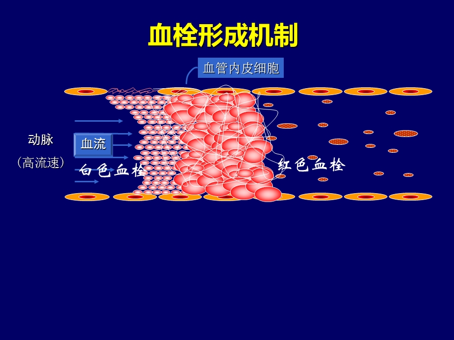 ACS危险分层及抗血小板优化治疗解读.ppt_第3页