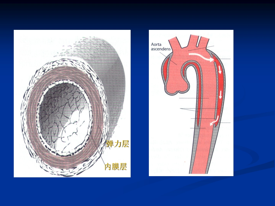 主动脉夹层动脉瘤【PPT】 .ppt_第2页