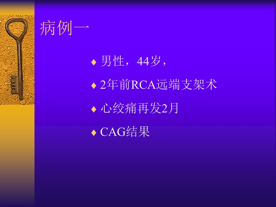 PCI时无再流的处理体会1.ppt_第2页