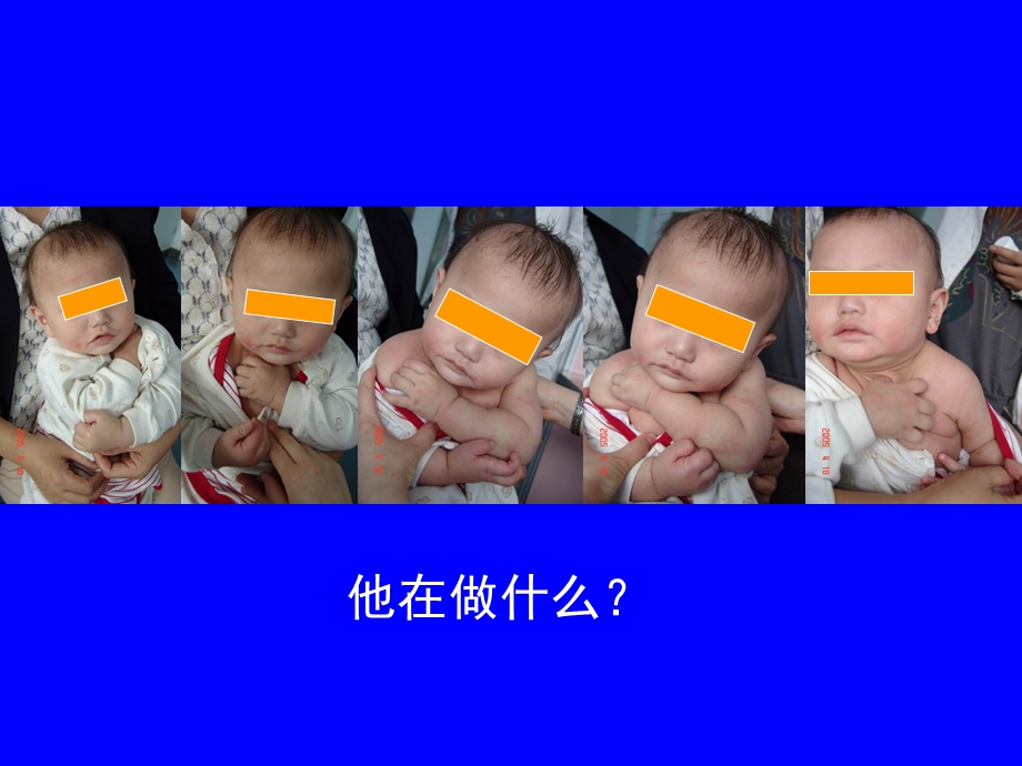 揭秘婴幼儿食物过敏(济南1103崔玉涛).ppt_第2页