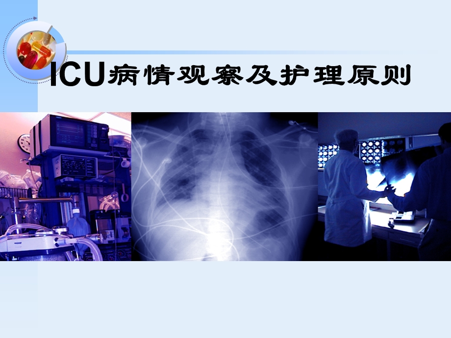 ICU病情观察及护理原则.ppt_第1页