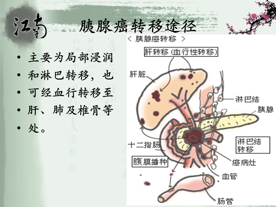 胰腺癌病人的护理.ppt_第3页