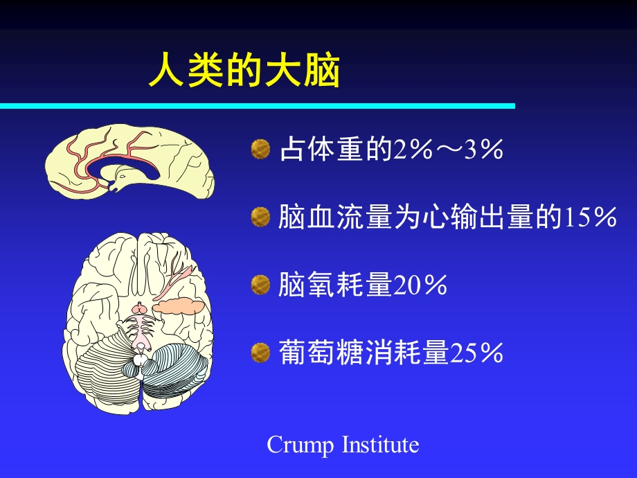 血管性痴呆.ppt_第3页