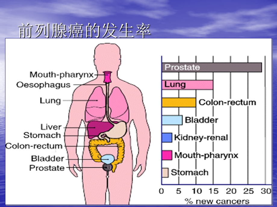 前列腺癌诊治进展.ppt_第2页