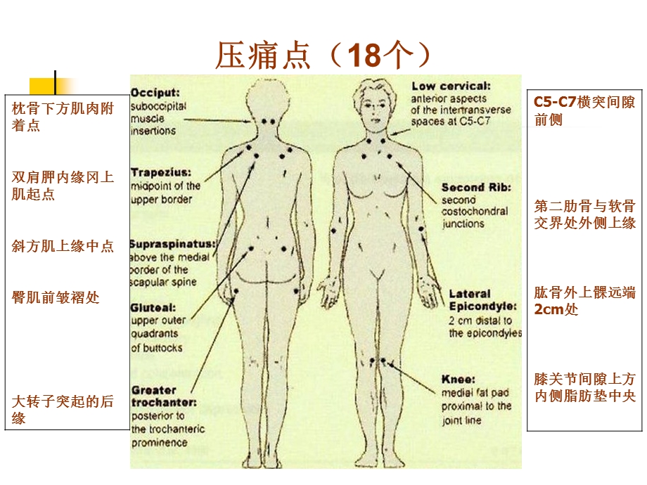 2金欧纤维肌痛综合征.ppt_第3页