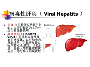 病毒性肝炎.ppt