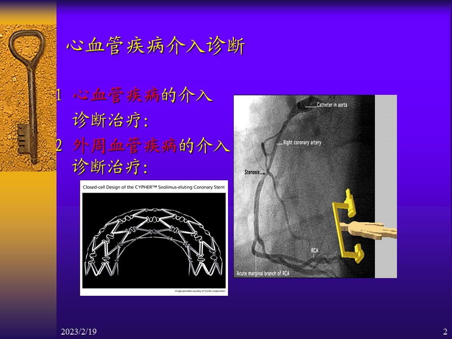 心血管疾病介入诊断治疗护理.ppt_第2页