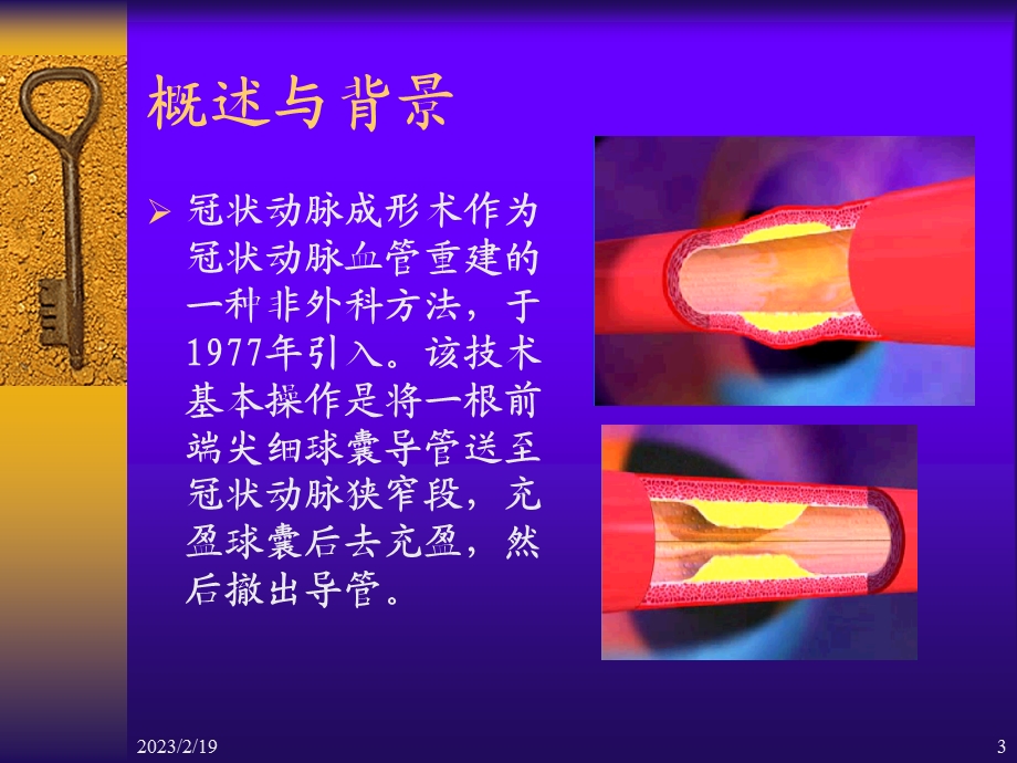 心血管疾病介入诊断治疗护理.ppt_第3页