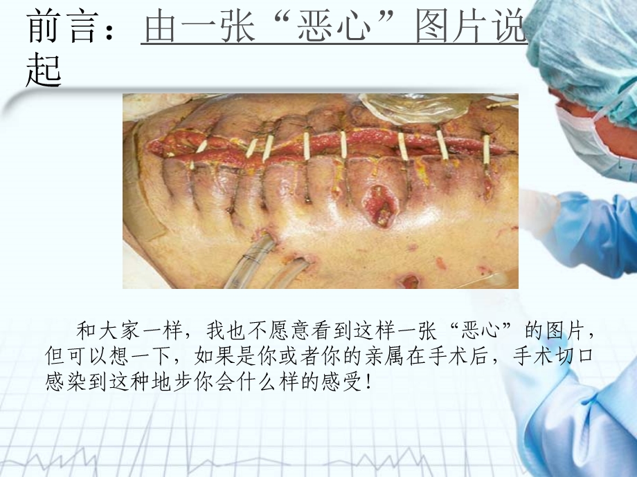 近年国内医院感染案例启示.ppt_第2页