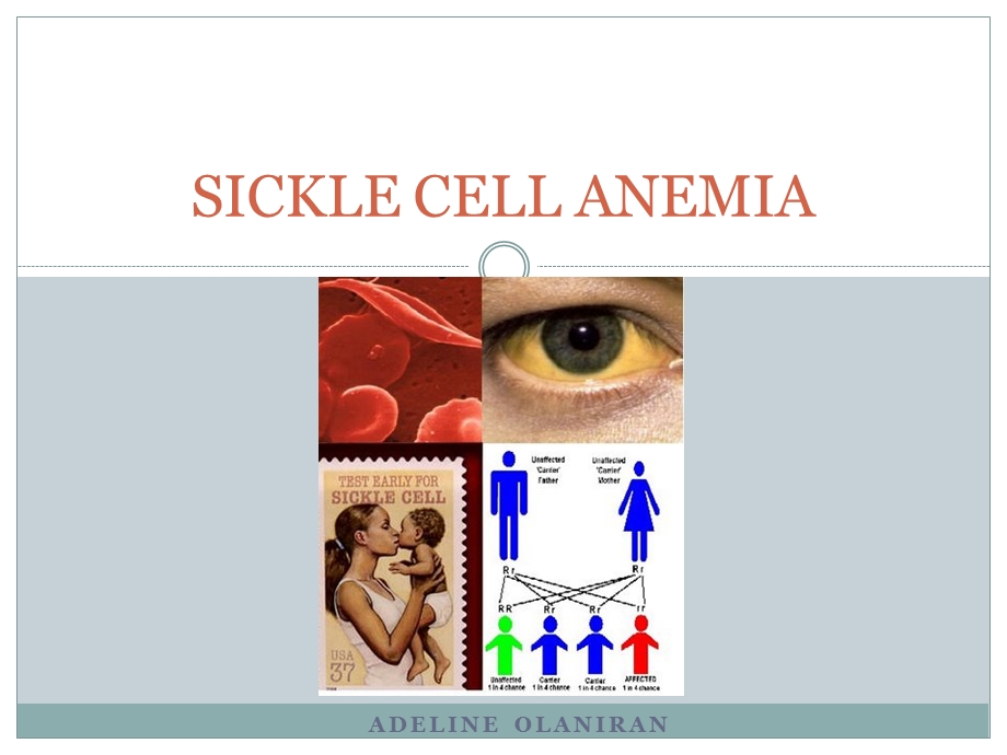 SICKLE CELL ANEMIA.ppt_第1页