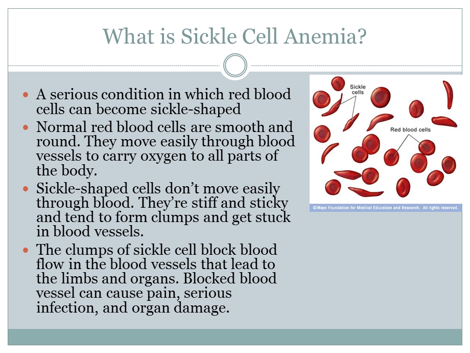 SICKLE CELL ANEMIA.ppt_第2页