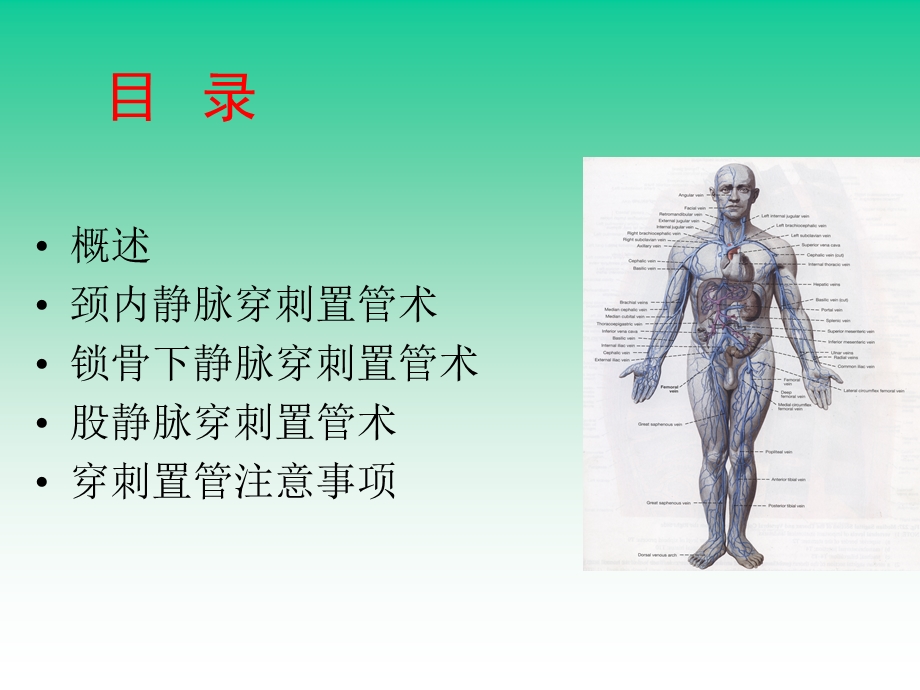 中心静脉穿刺置管术.ppt_第2页