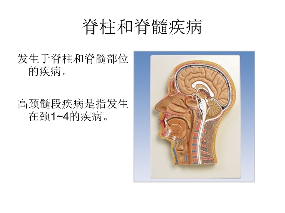 椎管疾病及术后护理.ppt_第2页