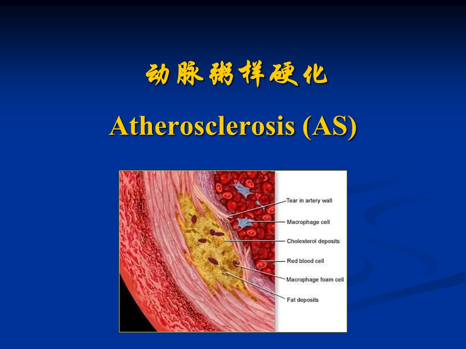 动脉粥样硬化(1).ppt_第2页