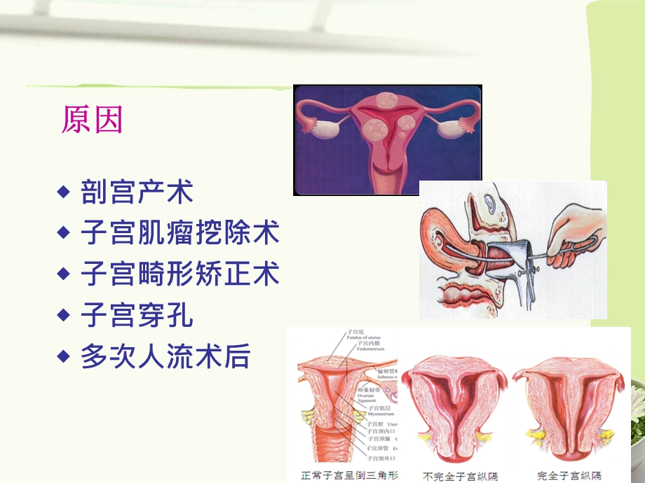 129_3605191_产后出血指南2014,镇海2015.ppt_第3页