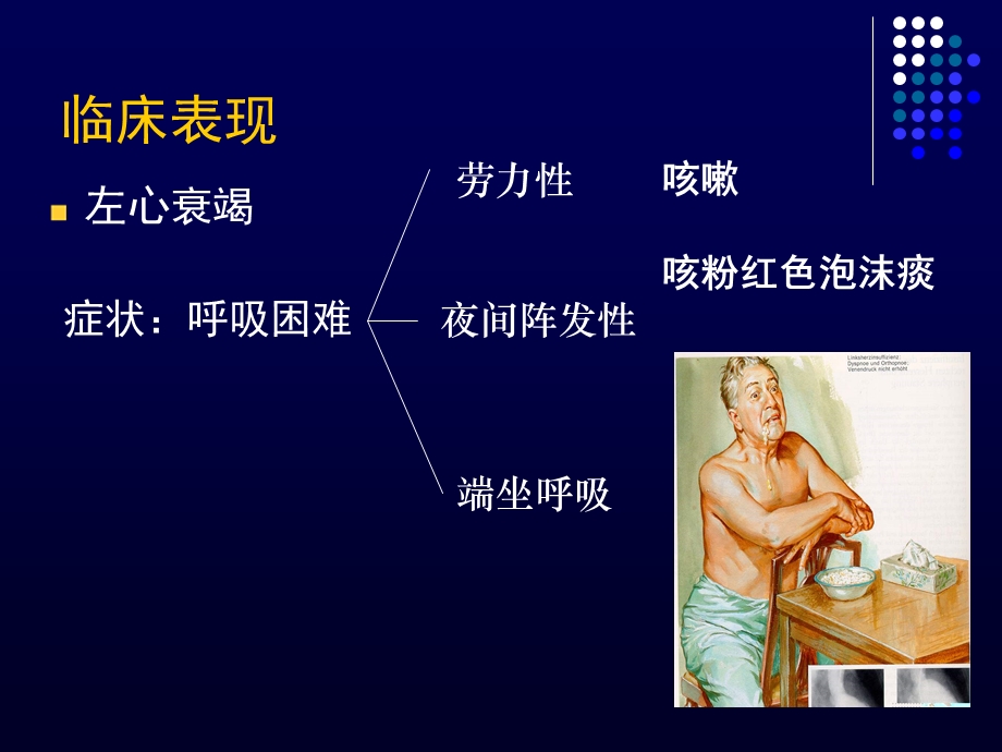 心力衰竭的诊断和治疗.ppt_第3页